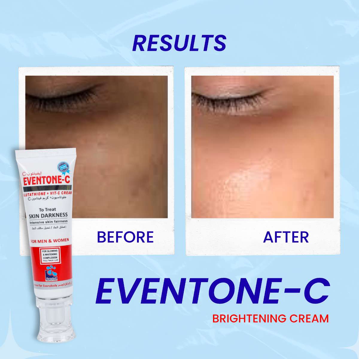 Eventone C Cream L-Glutathione + Vitamin C