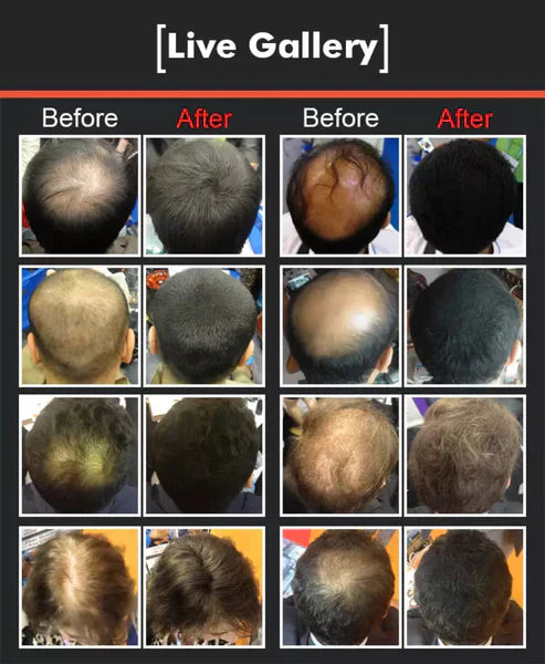 Hair Building Fibers (Imported)